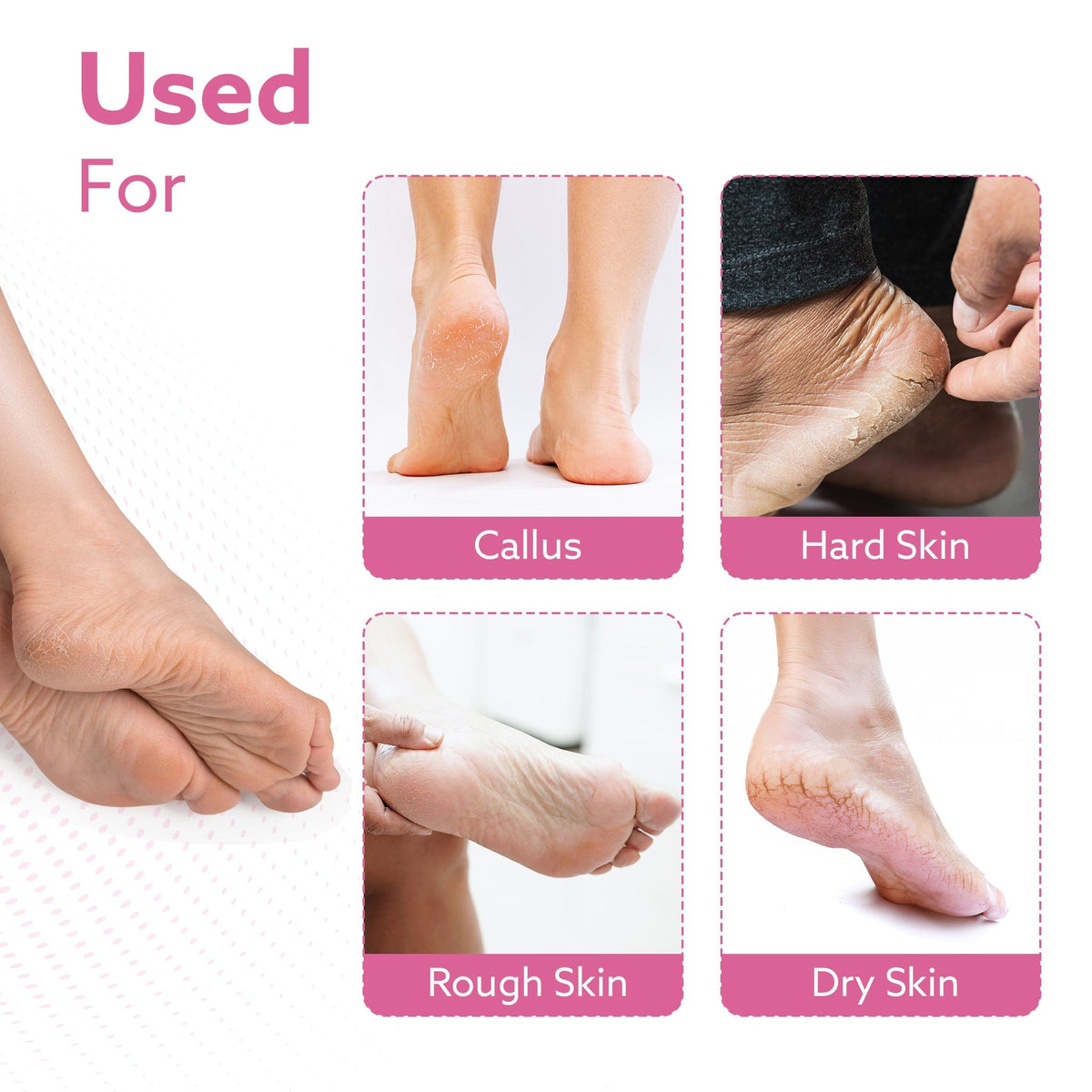 AGARO Callus Remover Replaceable Heads, 2 Pcs, Callus & Dead Skin Removal Filer, Pedicure at Home