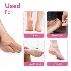 AGARO Callus Remover Replaceable Heads, 2 Pcs, Callus & Dead Skin Removal Filer, Pedicure at Home