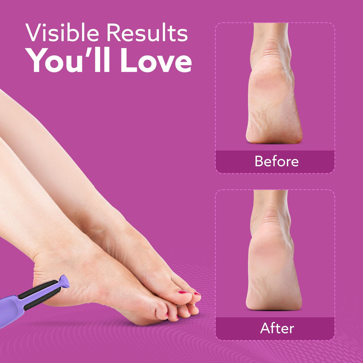 AGARO CR1414 Electric Callus Remover with 2 Replaceable Heads – Rechargeable Foot Scrubber for Dead Skin & Cracked Heels
