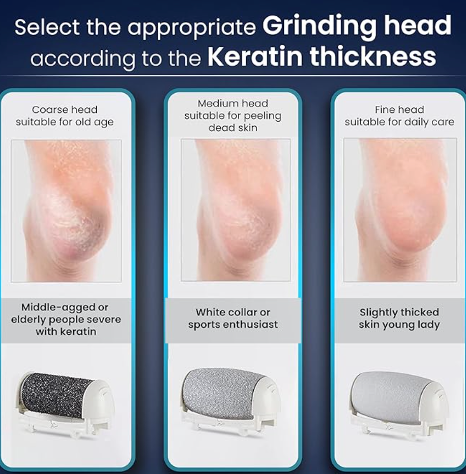 AGARO Callus Remover Replaceable Heads, 3 Pcs, Callus & Dead Skin Removal Filer, Pedicure At Home-2